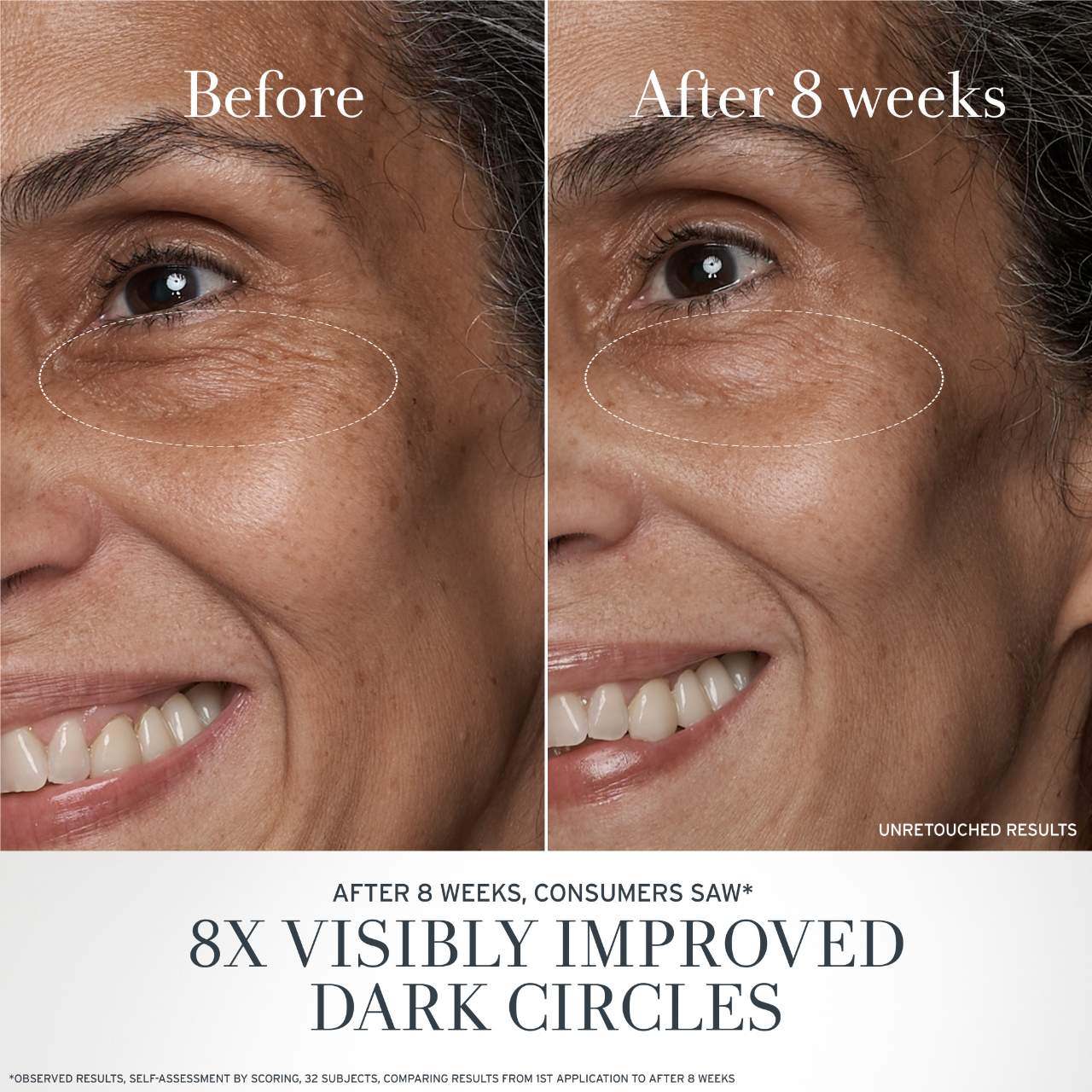 Black Tea Antiaging Eye Cream With Retinolalternative Bt Matrix