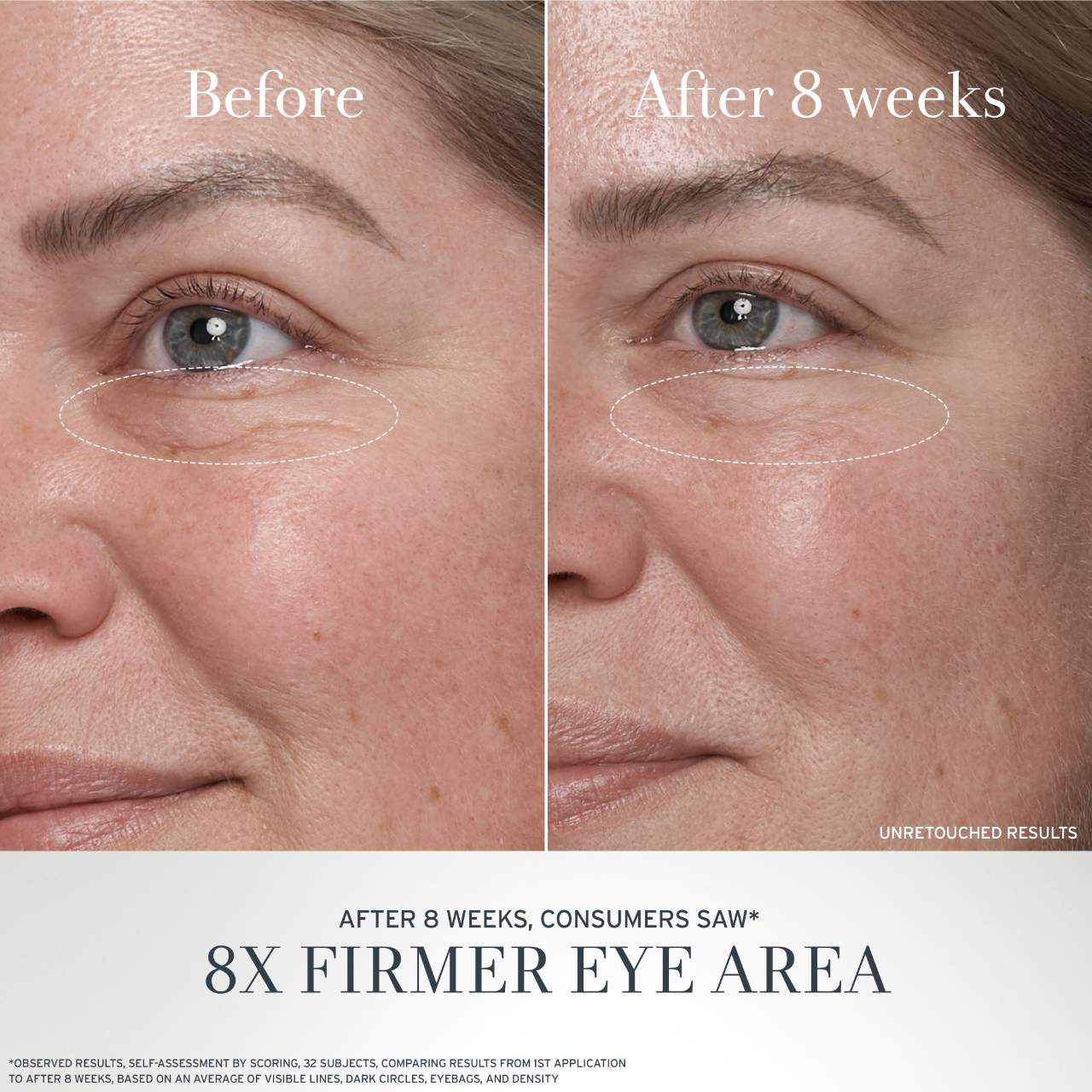 Black Tea Antiaging Eye Cream With Retinolalternative Bt Matrix